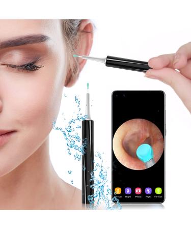 Ear Wax Removal Endoscope  Earwax Remover Tool  Ear Camera 1080P FHD Wireless Ear Otoscope with 6 LED Lights Ear Scope with Ear Wax Cleaner Tool for iPhone  iPad & Android Smart Phones (Black)
