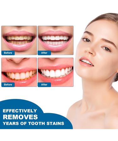 Teeth Whitening Essence Teeth Whitening Essence Pen Teeth Stain Remover to Whiten Teeth Teeth Whitening Gel Fast and Effective Removal Intensive Tooth Stain Removal(3pcs) - Buy Online on GoSupps.com