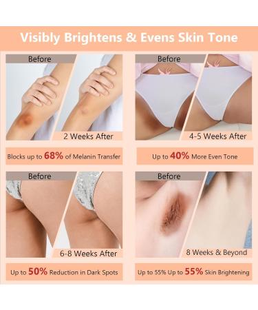 100ml Skin Bleaching Cream - Dark Spots Remover Lightening Cream & Uneven Tone Nourishing Formula Bleaching Intimate Areas & Underarms Inner Thigh Bikini Line Armpit Knees Elbows for All Skin Types - Buy Online on GoSupps.com
