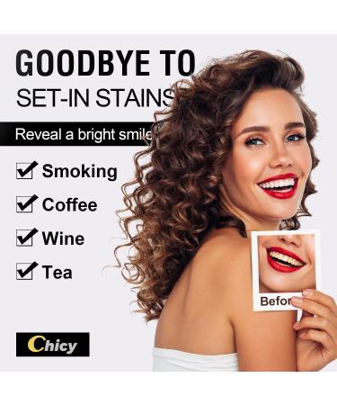 Non-Sensitive Teeth Whitening Strips - 56 Count Non-Slip Kit for Quick, Professional Results | Natural Coconut Flavor - Black & Golden - Buy Online on GoSupps.com