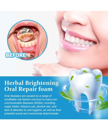 Jorondy Teeth Mouthwash & Furzero Herbal Foam - Tartar Removal Tooth Whitening Mousse (3PCs) - Deep Cleaning Oral Care - Buy Online on GoSupps.com