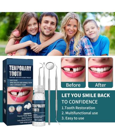 Tooth Repair Kit - Moldable Temporary Filling DIY Dental Care for Missing & Broken Teeth - Buy Online on GoSupps.com