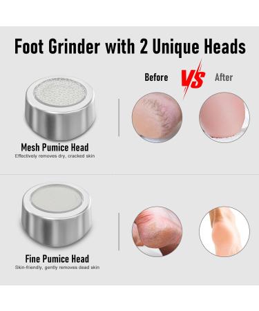 Buy Upgraded 3.0 Electric Callus Remover - Effective Exfoliation Rechargeable Low Noise & Easy to Clean - International Shipping Available - Buy Online on GoSupps.com