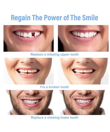 Fake Teeth Repair Kit - Moldable False Tooth for Fixing Broken & Missing Teeth - Natural Look - Set of 60 - Buy Online on GoSupps.com