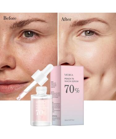 Hsypti Niacinamide Peach 70 Serum 30 ml hyaluron antiwrinkle facial serum moisturizing facial serum for face skin care - Buy Online on GoSupps.com