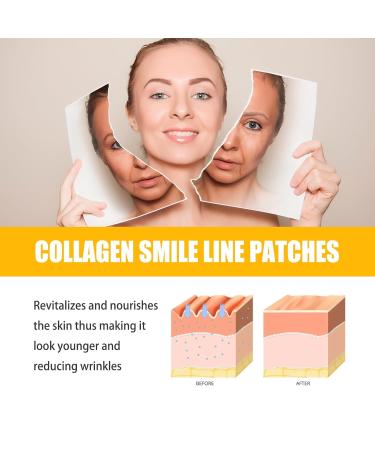 Smile Line Patches - 10pcs Collagen Hydrating Masks for Anti-Aging Smoothing Laugh Lines & Wrinkles - Buy Online on GoSupps.com