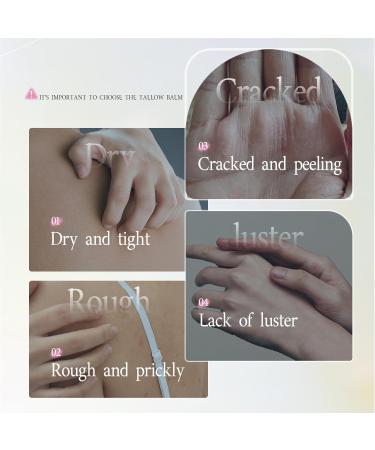 GINILOO Beef Tallow for Skin - Grass Fed Beef Tallow with Butter Honey Jojoba Oil Body & Face Moisturizer Deep Nourishment for Dry Cracked Sensitive Skin - 5.3OZ - Buy Online on GoSupps.com