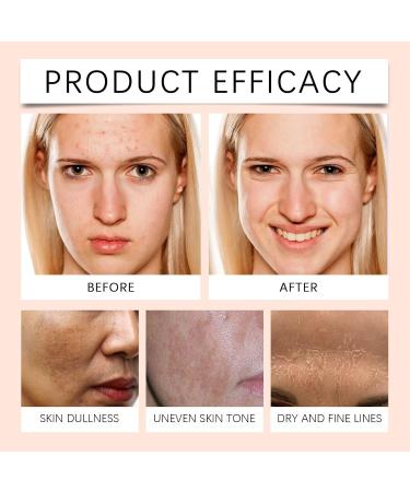 Body Skin Brightening Cream Brown Spot Remover for Face and Body Intimate Area Intimate Area Armpits Knees Elbows Inner Thighs Bikini Areas - Buy Online on GoSupps.com