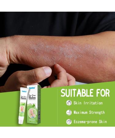 Tea Tree Oil Anti-Itch Cream for Psoriasis & Eczema - Natural Herbal Ingredients, Sensitive Skin Soothing Moisturizer (0.7oz x 10) - Buy Online on GoSupps.com