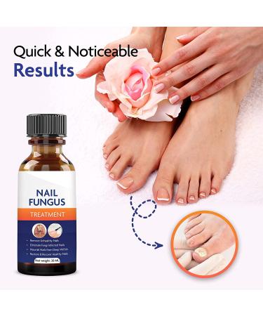 Deep Blue 30ML Nail Fungus Treatment | Extra Strength Toe & Nail Fungus Treatment - Buy Online on GoSupps.com