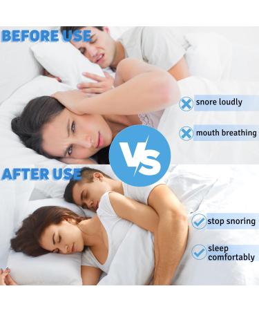 Crethink Neck Support: Anti-Snoring Chin Strap for Restful Sleep - Sleep Apnea Relief - Adjustable Fit - Buy Online on GoSupps.com
