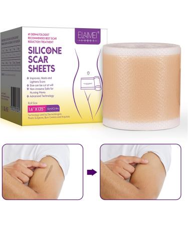 Medical Grade Silicone Scar Sheets & Tape Roll - Keloid Treatment C-Section & Old Scars - Reusable Strong Adhesion Waterproof 1.6in x 135in - Buy Online on GoSupps.com