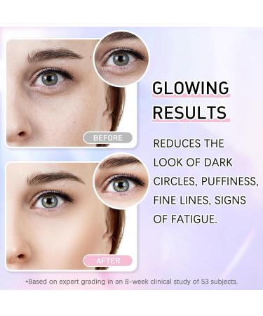 Boxmom 60ml Caffeine Eye Cream Eye Serum Set Under Eye Cream Anti Aging for Dark Circles And Puffy Eyes Retinol Eye Serum & Eye Roller (Eye Cream & Serum) Pink Set - Buy Online on GoSupps.com