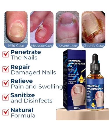 German Toenailplus & NailPro Anti Paronychia Relief Oil - Set of 2Pcs / 3Pcs - Buy Online on GoSupps.com