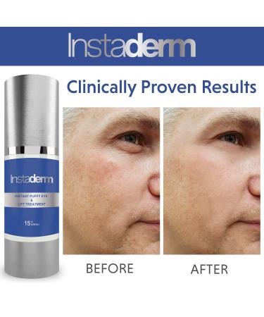 Puffy Eye & Lift Treatment: Eliminate Bags, Dark Circles & Wrinkles Instantly - Buy Online on GoSupps.com