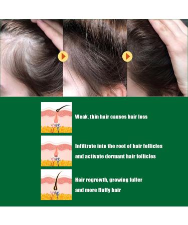 Ginger Anti Hair Loss Serum for Hair Regrowth - Men & Women - 3pcs 1 Fl Oz - Buy Online on GoSupps.com