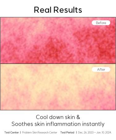 Madecassoside Blemish Control Toner Pads | 120 Vegan Gauze Pads for Uneven Skin Tone | Centella Asiatica Niacinamide Low pH Sensitive Skin Care - Buy Online on GoSupps.com