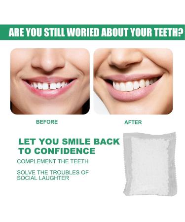 Temporary Tooth Repair Set - Degradable 25g Tooth Filling & Replacement for Missing Teeth | International Shipping Available - Buy Online on GoSupps.com