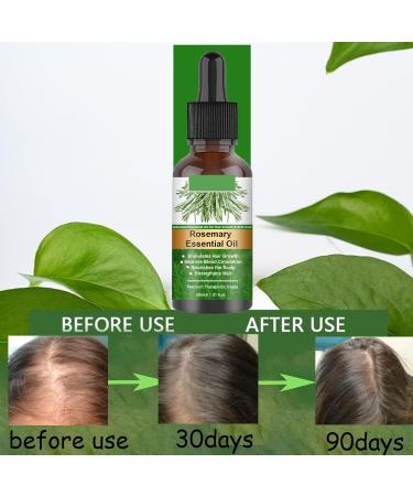Rosemary Oil for Hair Growth 60ml Hair Oil Diminishes Signs of Aging Nourishes the Scalp Strengthens Hair Stimulates Hair Growth Treat Dry Damaged Hair Rosemary Essential Oil for Hair Growth 2 Brush 30ml - Buy Online on GoSupps.com