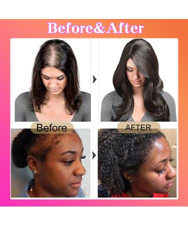 Raw Batana Oil for Hair Growth | Thickening & Split End Treatment | Prevent Hair Loss - Premium Honduran Hair Oil - Buy Online on GoSupps.com