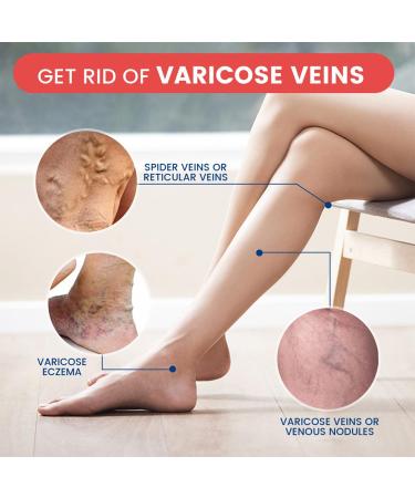  MagiSel Varicose Vein Cream Cream Against Spider Veins Varicose Vein Leg Care Cream 20g Spider Vein Varicose Vein Cream for Legs Eliminates Varicose Veins and Spider Veins - Buy Online on GoSupps.com
