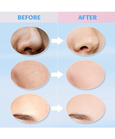 IIIMEIDU Turmeric Vitamin C Clay, Green Tea & Dead Sea Mud Face Mask Set - Deep Cleansing & Anti Aging Women's Skin Care - 2.5 FL Oz Each - Buy Online on GoSupps.com