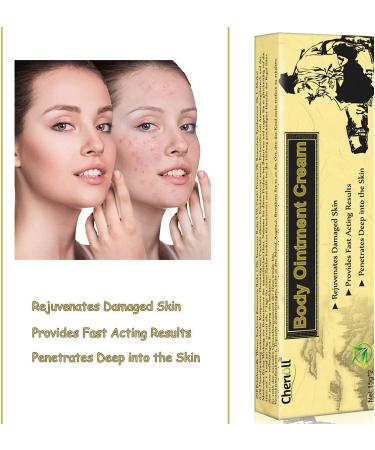 Moisturising Cream Body and Face Moisturizer for Dry Skin Acne Cream 2PC 0.53 Ounce (Pack of 2) - Buy Online on GoSupps.com