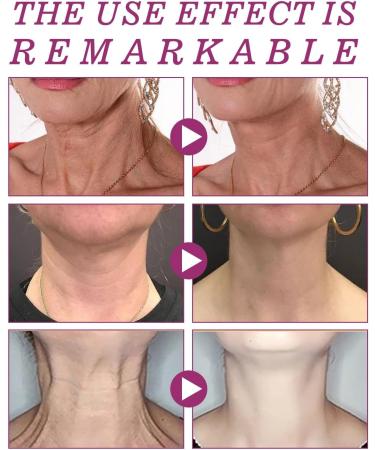 Hydrolyzed Collagen Neck Cream is smooth tender and white smoothing and lightening neck lines shaping a swan neck beauty cream 40g - Buy Online on GoSupps.com