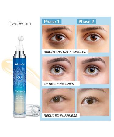 5% Caffeine Eye Cream - Brightening Eye Roller for Puffiness & Dark Circles Treatment | Under Eye Serum & Oil Roller - Buy Online on GoSupps.com