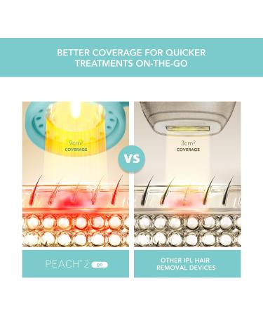 FOREO Peach 2 Go IPL Hair Removal Device - Travel-Friendly Painless Laser Hair Removal for Body & Face Skin Cooling & Silicone Shield - Customizable Arctic Blue - Buy Online on GoSupps.com