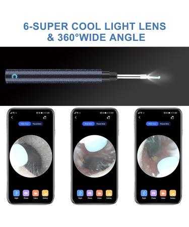 Wireless Ear Otoscope with Camera | Ear Wax Removal Tool | 1296P FHD | 6 LED Lights | Ear Cleaner - Buy Online on GoSupps.com