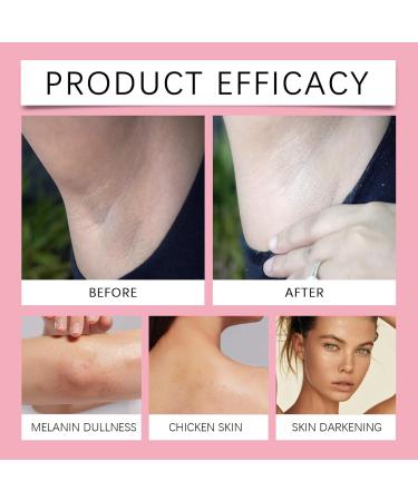 Body Butter For Women - Strawberry Body Butter - Body Lotion Scented - Body Creams For Dry Skin - Face & Body Moisturizer Contains Natural Fruit Extracts - Soft & Hydrating Skin 114g - Buy Online on GoSupps.com