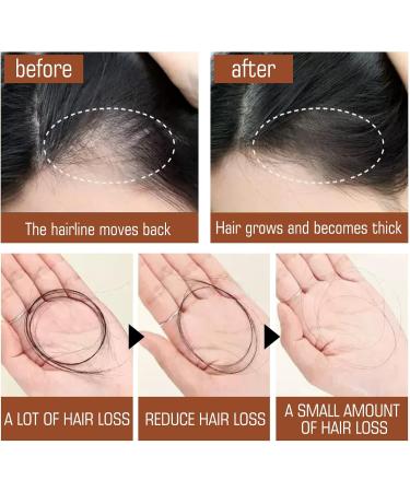 Bio Batana Unrefined Batana Oil from Honduras for Healthier Thicker Fuller Hair (Pack of 5) - Buy Online on GoSupps.com