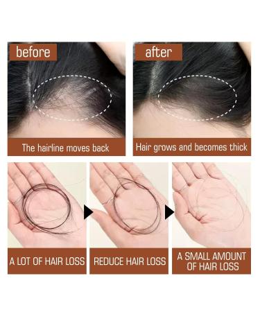 Buy 100% Natural Batana Oil for Hair Growth - Dr. Sebi Inspired Prevent Hair Loss & Enhance Thickness - Raw from Honduras - Buy Online on GoSupps.com