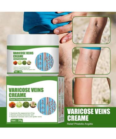 Varicose Veins Cream - 2pcs for Relief of Phlebitis, Angiitis, Inflammation, and Vasculitis Treatment - Improve Blood Circulation for Tired and Heavy Legs - Buy Online on GoSupps.com
