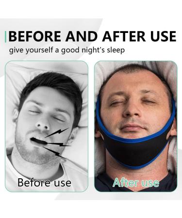 Anti Snoring Chin Strap - Adjustable CPAP Sleep Aid for Men & Women | Stop Snoring Jaw Strap (Pink - Buy Online on GoSupps.com