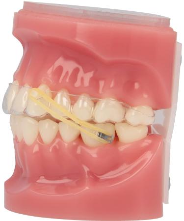 American Orthodontics Falcon Wildlife Elastics | 1/4 Size 2.5 O | 100 Packs Per Box, 10,000 Elastics | Made in USA | Top Quality Latex Tubing - Buy Online on GoSupps.com