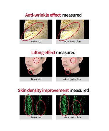 Dr. Different VITALIFT-A | Retinal Anti-Aging Night Treatment | Firming Face Moisturizer with Vitamin A & Hyaluronic Acid | Hydrating Cream for Men & Women | 0.7oz - Buy Online on GoSupps.com