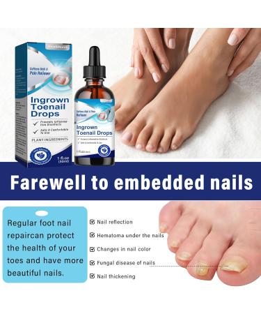 Nail Treatment Nail Repair Solution for Toenails cuticle protection & strengthening Restoring Nails 30ML - Buy Online on GoSupps.com
