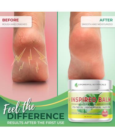 Extra Strength Tea Tree Balm for Skin | Athlete's Foot Jock Itch & Ringworm Relief Cream | Fast Acting Physician Formulated 2oz - Buy Online on GoSupps.com