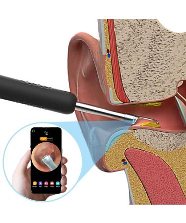 BEBIRD R1 Ear Wax Removal Tool Camera Endoscope - 1080P HD Wireless Ear Cleaner with 6 LED Lights for iPhone, iPad, Android - Kids, Adults & Pets (Black) - Buy Online on GoSupps.com