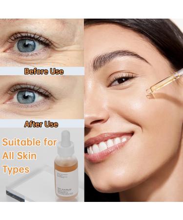 Lactic Acid Serum for Women | 30ML Exfoliating Moisturizer with 5% Lactic Acid & Hyaluronic Acid - Best for Dry Skin - Buy Online on GoSupps.com