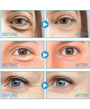Eye Cream - Under Eye Cream Coffee Extract Eye Cream | Instant Eye Bag Removal Cream With Natural Ingredients Natural Firming Skin Eye Moisturizer For Women Girls - Buy Online on GoSupps.com