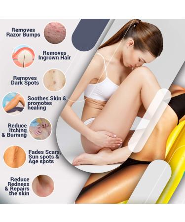 Roll On Razor Bump Treatment for Bikini Area, Legs, Underarms - Natural Dark Spot Removal & Ingrown Hair Relief for Women & Men - Buy Online on GoSupps.com