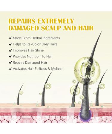 Hair Growth Oil with 5% Biotin - Nourishes Scalp and Stops Hair Loss - Promotes Stronger Thicker Hair for Men and Women Hair Regrowth Treatments with 0.25mm Roller (60ml) - Buy Online on GoSupps.com