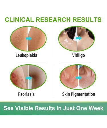Natural Vitiligo Treatment Cream - Improve Skin Pigmentation & Reduce White Spots | Works on All Skin Types - Buy Online on GoSupps.com