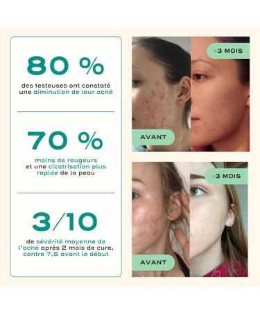 Circles Clear Detox Treatment for Skin and Body - Herbal and Mineral Supplement for Hormonal Acne in Adults - Vegan - Burdock Nettle Zinc Rosemary - 60 Capsules - Buy Online on GoSupps.com