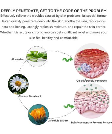 Max Strength Treat Natural Organic Manuka Honey Cream Ointment Soothing Relief for Dry Heat Rash Hidradenitis Itchy Eczema Psoriasis Leg Belly Armpit Foot Hand Irritable Skin For All Ages 4 Fl Oz (Pack of 1) - Buy Online on GoSupps.com