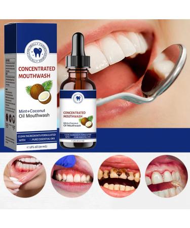 2PC Whitening Oil Mouthwash with Coconut Oil and Peppermint Oil Freshens Breath Eliminates Bad Breath Whitens Teeth Ourlyard Coconut Oil Mouthwash - Buy Online on GoSupps.com