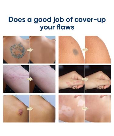 Tattoo Cover Up Concealer - Waterproof and Natural-looking | 2 Colors for Tattoos, Scars, Dark Spots, Birthmarks, Vitiligo - Buy Online on GoSupps.com